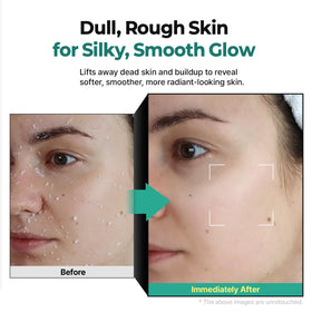 MOTHER MADE before and after forehead smoothing demonstrating improved texture