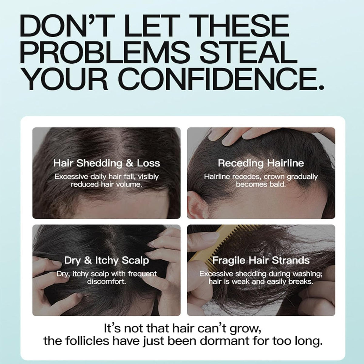 MQN illustrated before and after concept showing improved hair density