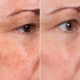 MSGBcg bottle label detail highlighting 12% vitamin C and 1% hyaluronic acid
