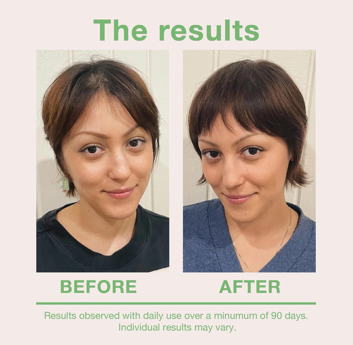 mumms dropper applying serum to scalp for targeted nourishment benefit
