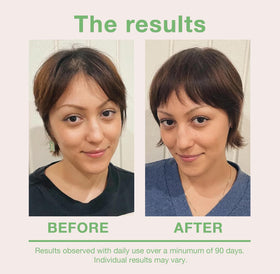 mumms dropper applying serum to scalp for targeted nourishment benefit