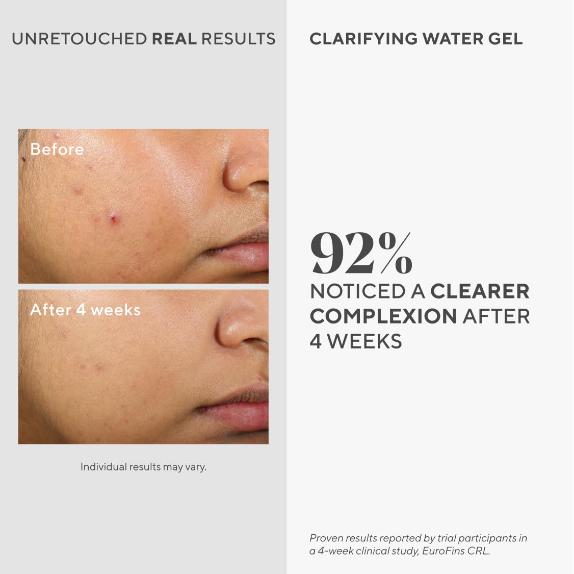 Murad clear gel texture close-up highlighting lightweight hydration and non-greasy finish
