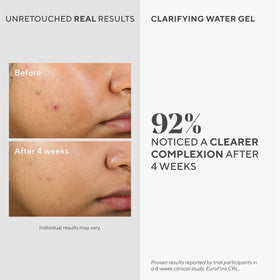 Murad clear gel texture close-up highlighting lightweight hydration and non-greasy finish