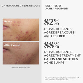 Murad applied on skin with invisible, patch-like finish to prolong treatment contact