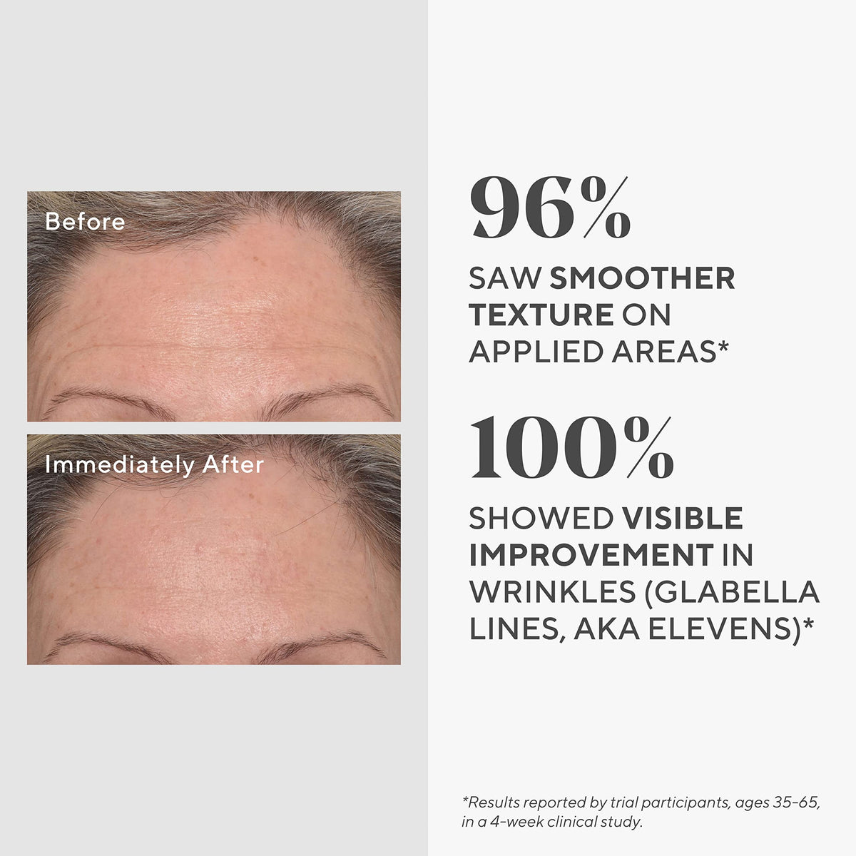 Murad ingredient graphic with hyaluronic acid and peptides for improved skin texture