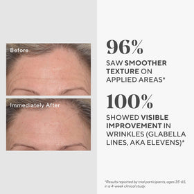 Murad ingredient graphic with hyaluronic acid and peptides for improved skin texture