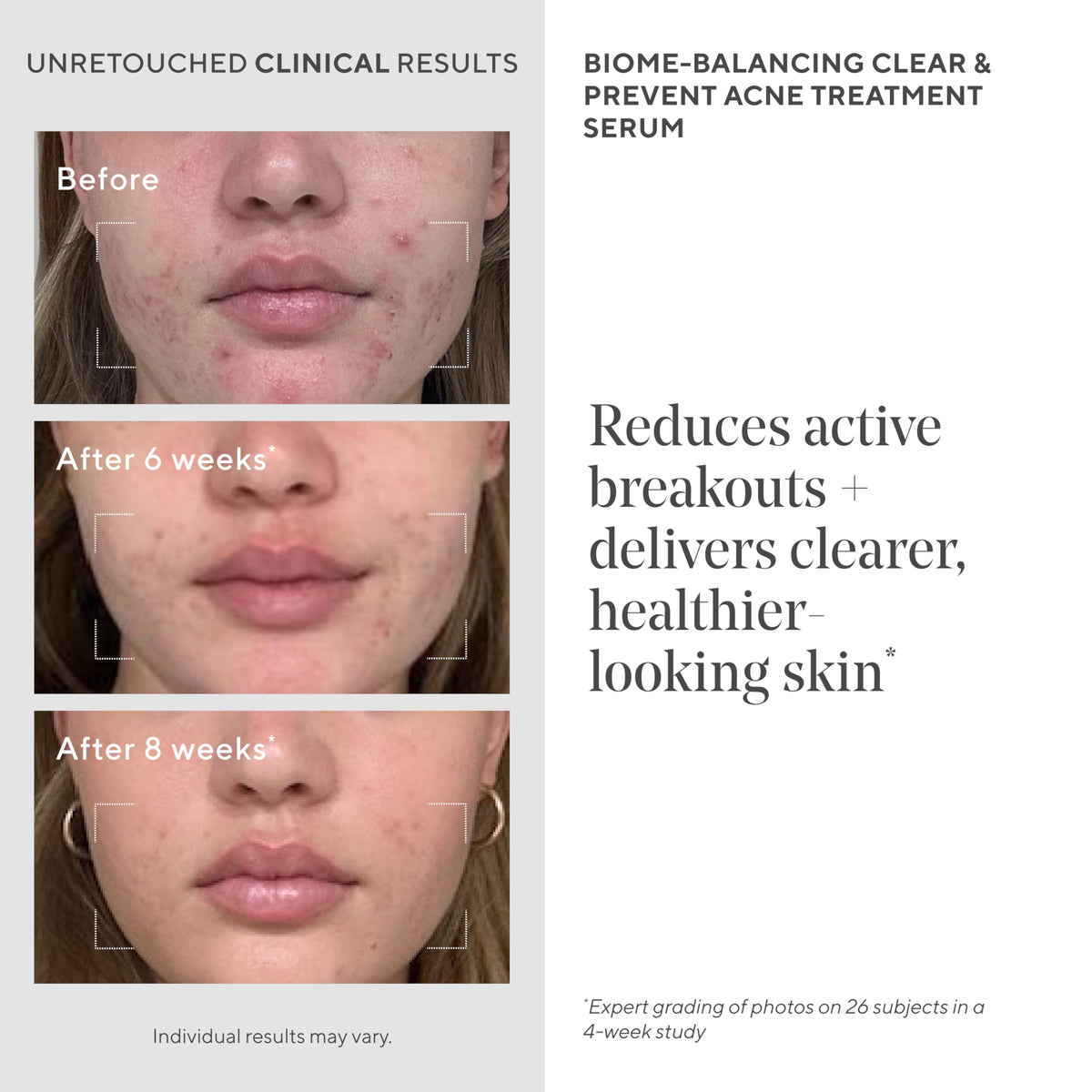Murad ingredients label detail displaying active acids and formulation benefit