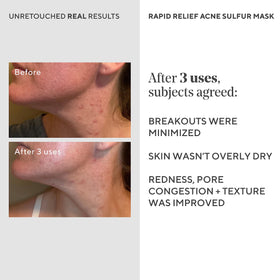 Rinsing Murad mask from skin demonstrating gentle removal without tugging benefit