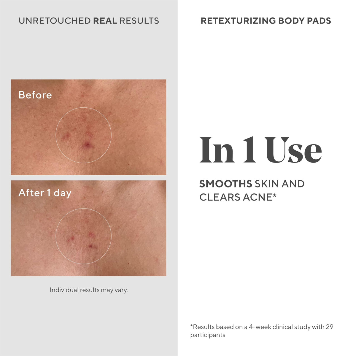 Murad single pad on hand ready to apply for convenient treatment