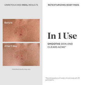 Murad single pad on hand ready to apply for convenient treatment