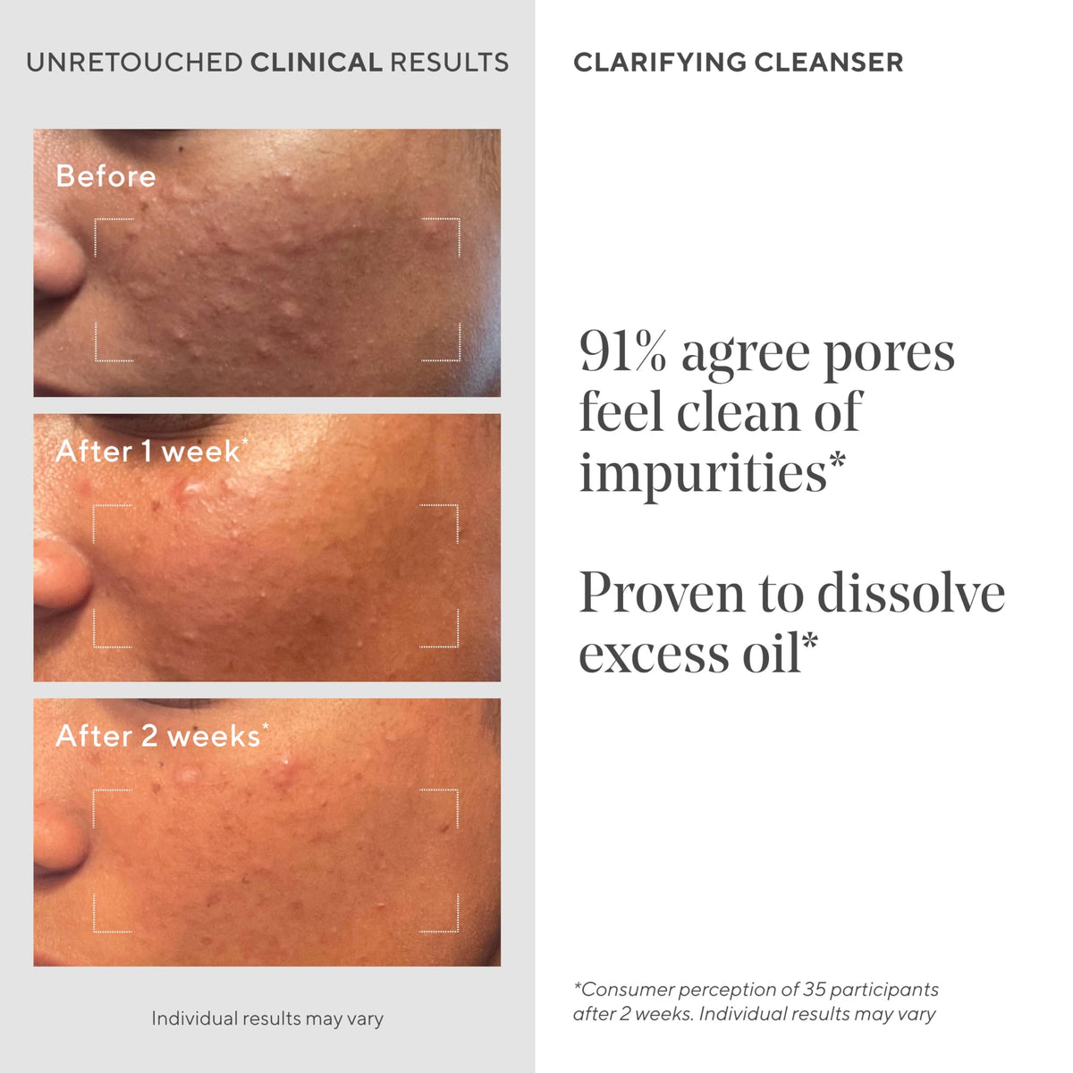 Murad visual of pores before and after showing clearer skin benefit