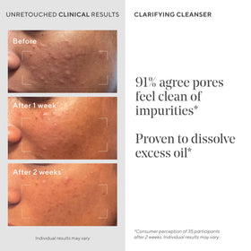 Murad visual of pores before and after showing clearer skin benefit