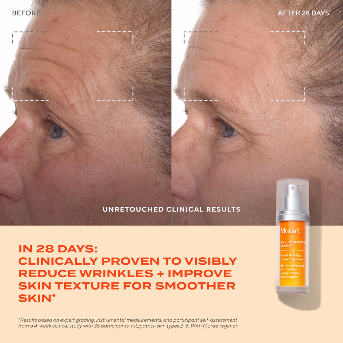 Murad ingredient graphic with tranexamic acid, communicates targeted brightening benefit