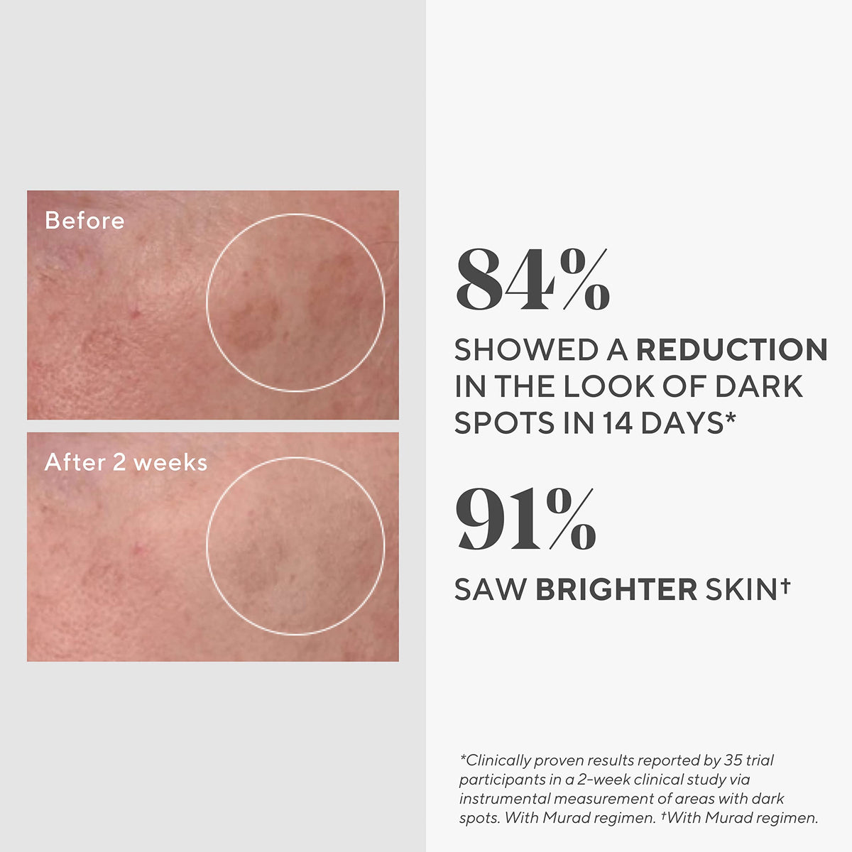 Murad serum texture on hand demonstrating lightweight formula and quick absorption