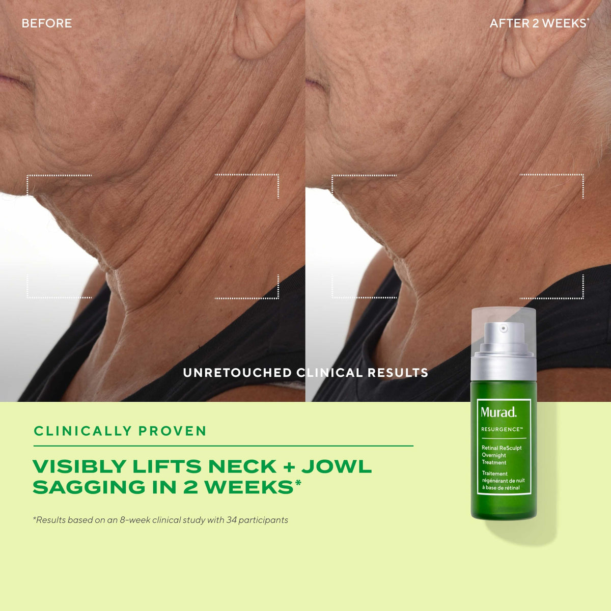 Murad being applied to neck illustrating lifting and smoothing benefit