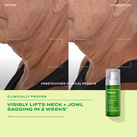 Murad being applied to neck illustrating lifting and smoothing benefit