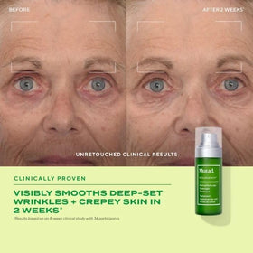 Murad 1 fl oz bottle with hand for scale, clarifies product size benefit