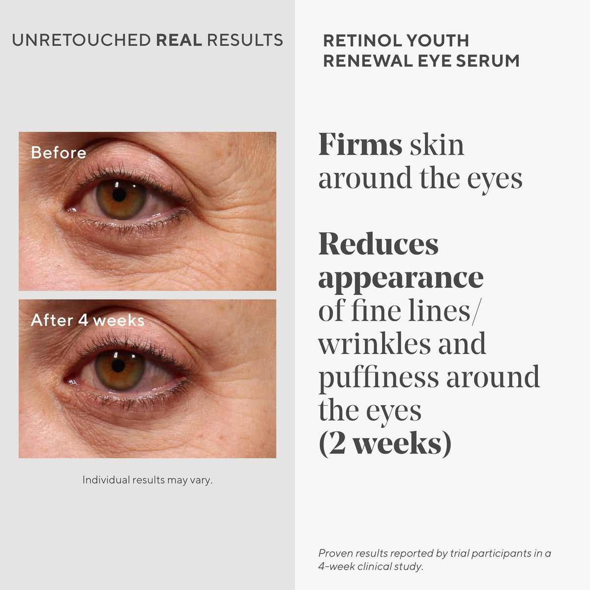 Murad retinol eye serum texture on fingertip showing lightweight absorbent benefit