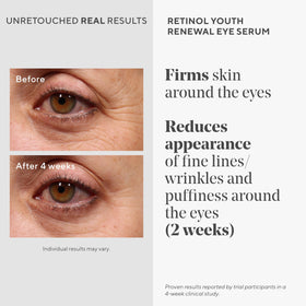 Murad retinol eye serum texture on fingertip showing lightweight absorbent benefit