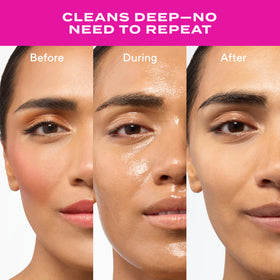 Murad rinsed skin portrait showing hydrated comfortable finish