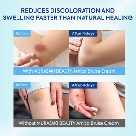 MURASAKI BEAUTY tube in hand for scale to show travel-ready size