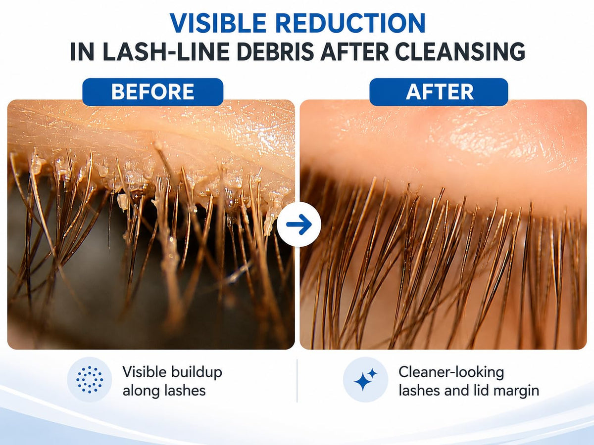 Myboclean gel texture on fingertip highlighting hydrating, gentle consistency