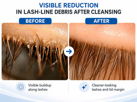 Myboclean gel texture on fingertip highlighting hydrating, gentle consistency