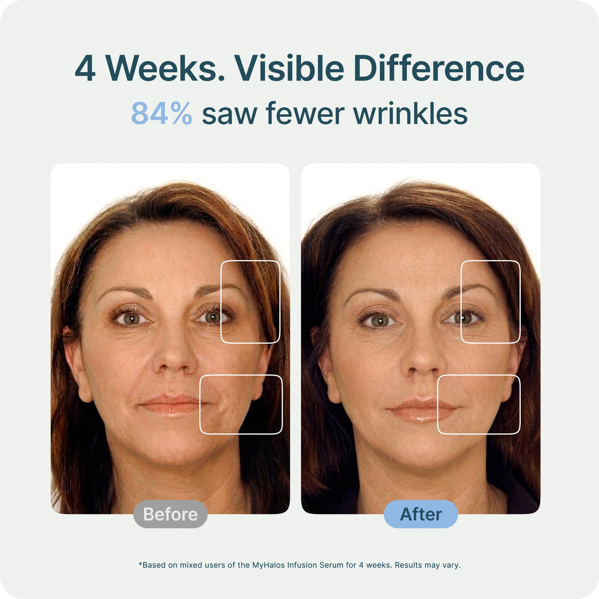 myhalos stamp in use on cheek demonstrating even serum delivery benefit