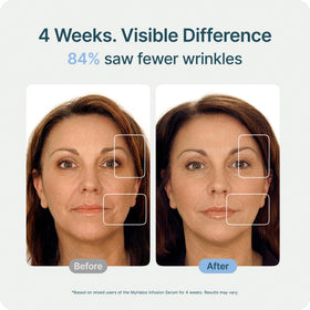 myhalos stamp in use on cheek illustrating effortless at-home treatment