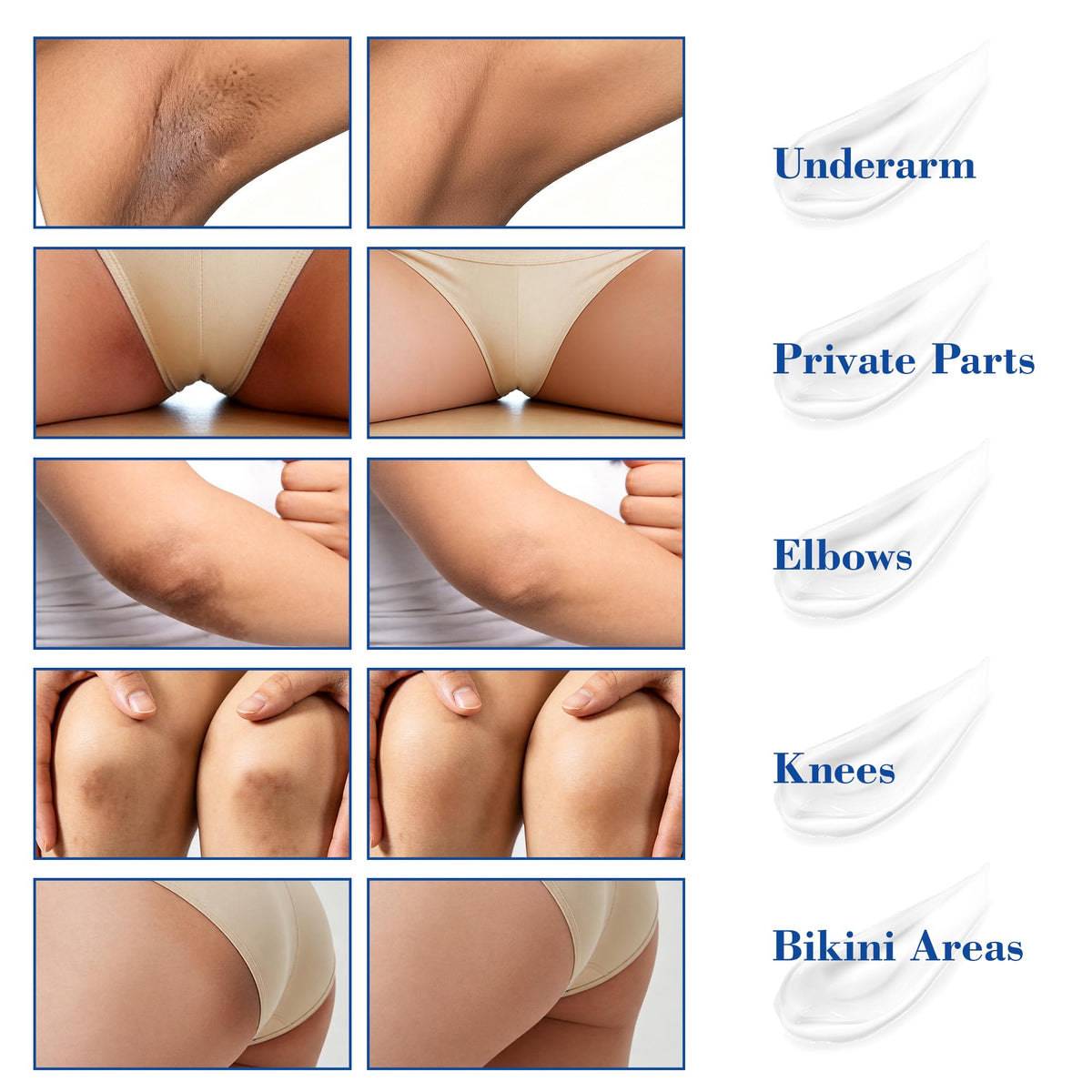 MyTend being applied to bikini line showing targeted external use benefit