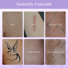MyTend before and after leg coverage illustrating tattoo and scar concealment