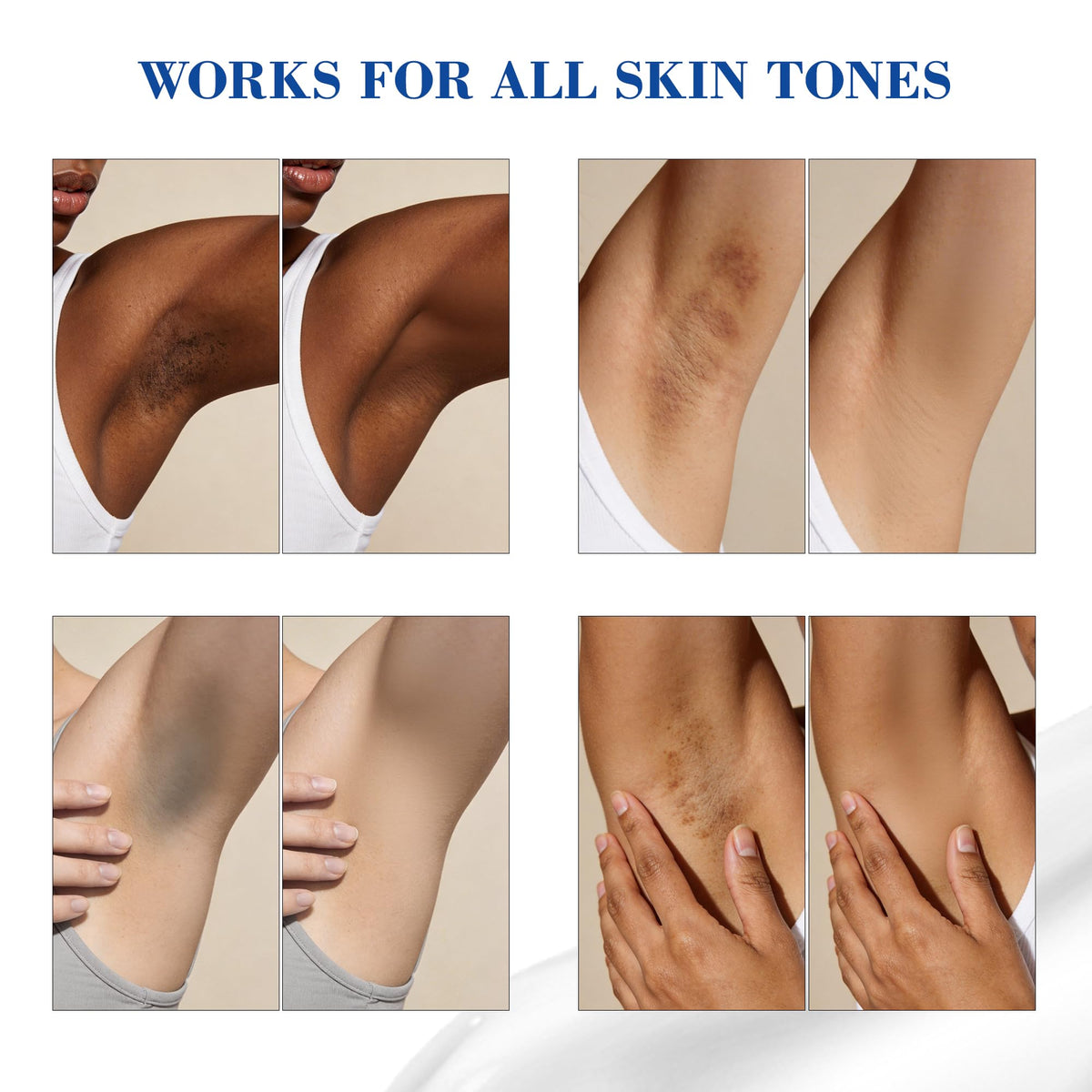 MyTend underarm application demonstrating even tone support and comfort
