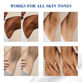 MyTend underarm application demonstrating even tone support and comfort