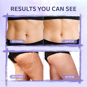 Applying MythosFlow cream to thigh demonstrating targeted smoothing and contouring