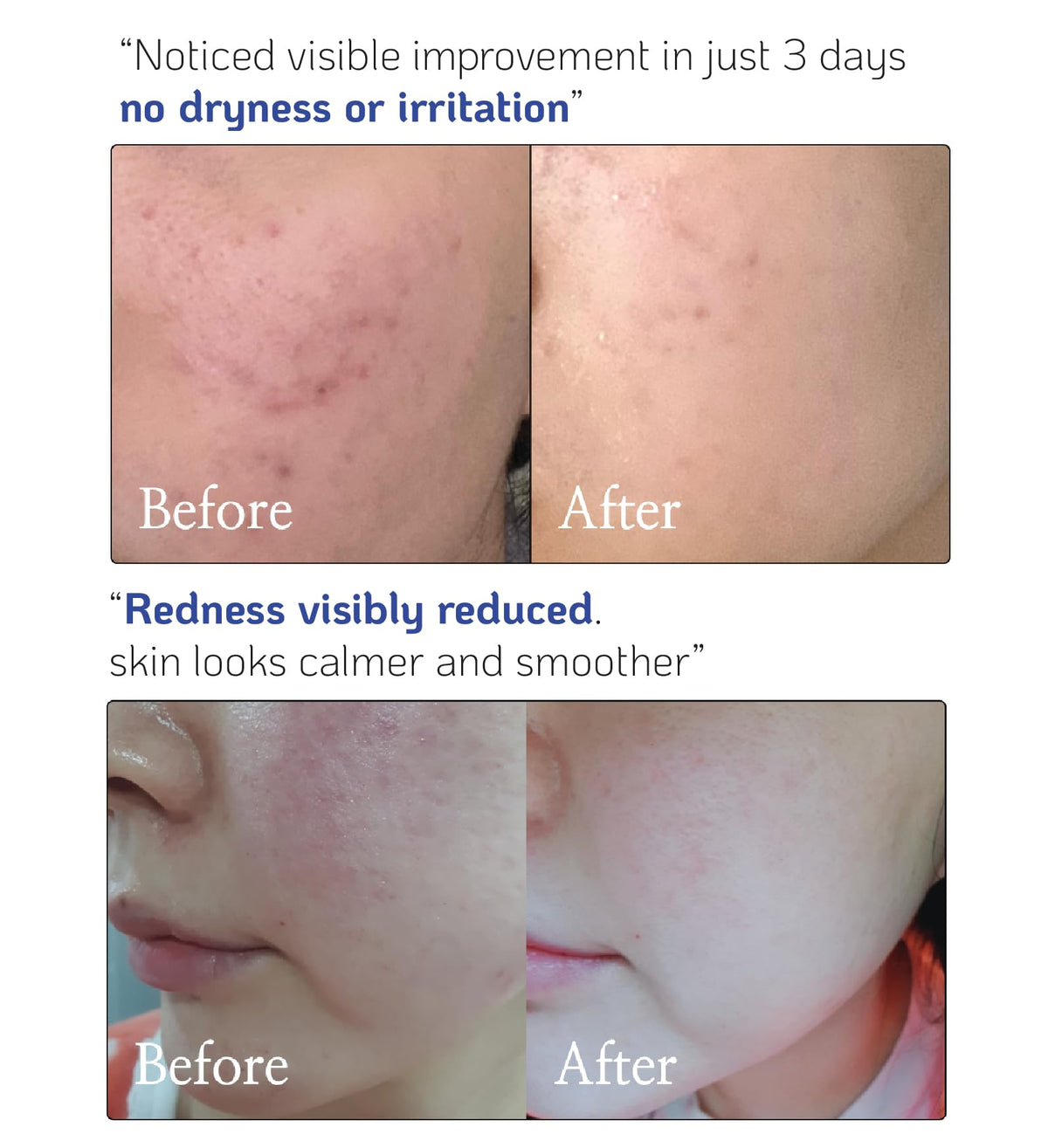 Nano Recipe showing mixing concentrate with moisturizer to boost hydration benefit