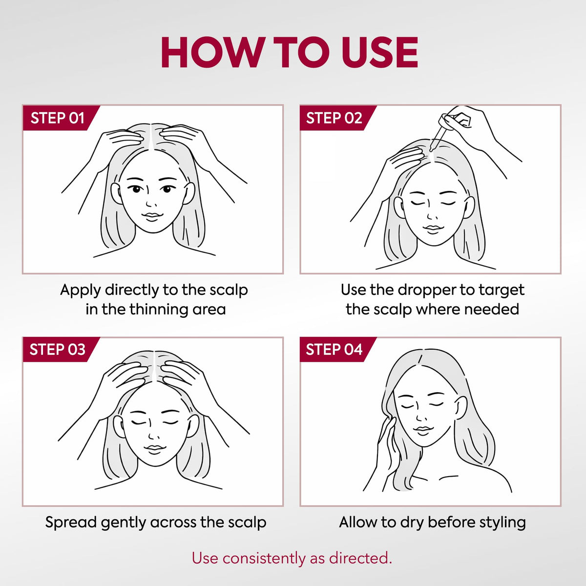 narcelax used on patchy beard zone illustrating focused placement and improved coverage