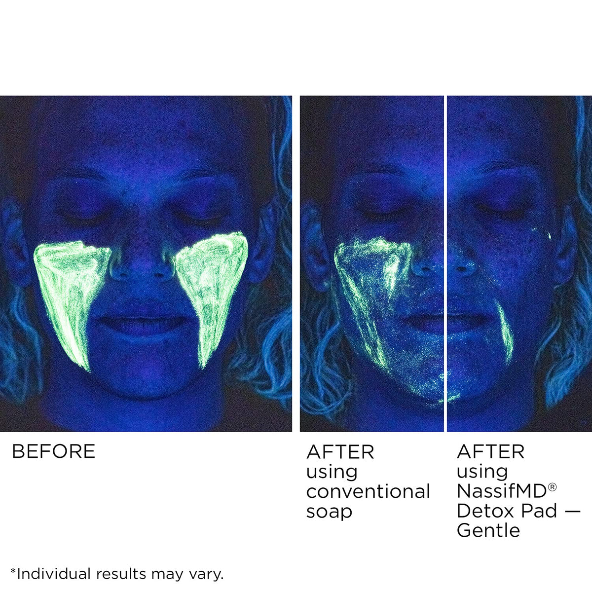 NassifMD ingredients label listing glycolic, salicylic, vitamin C and hyaluronic acid