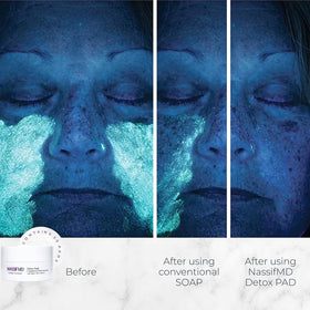 NassifMD pad close-up texture revealing soft, thin layer