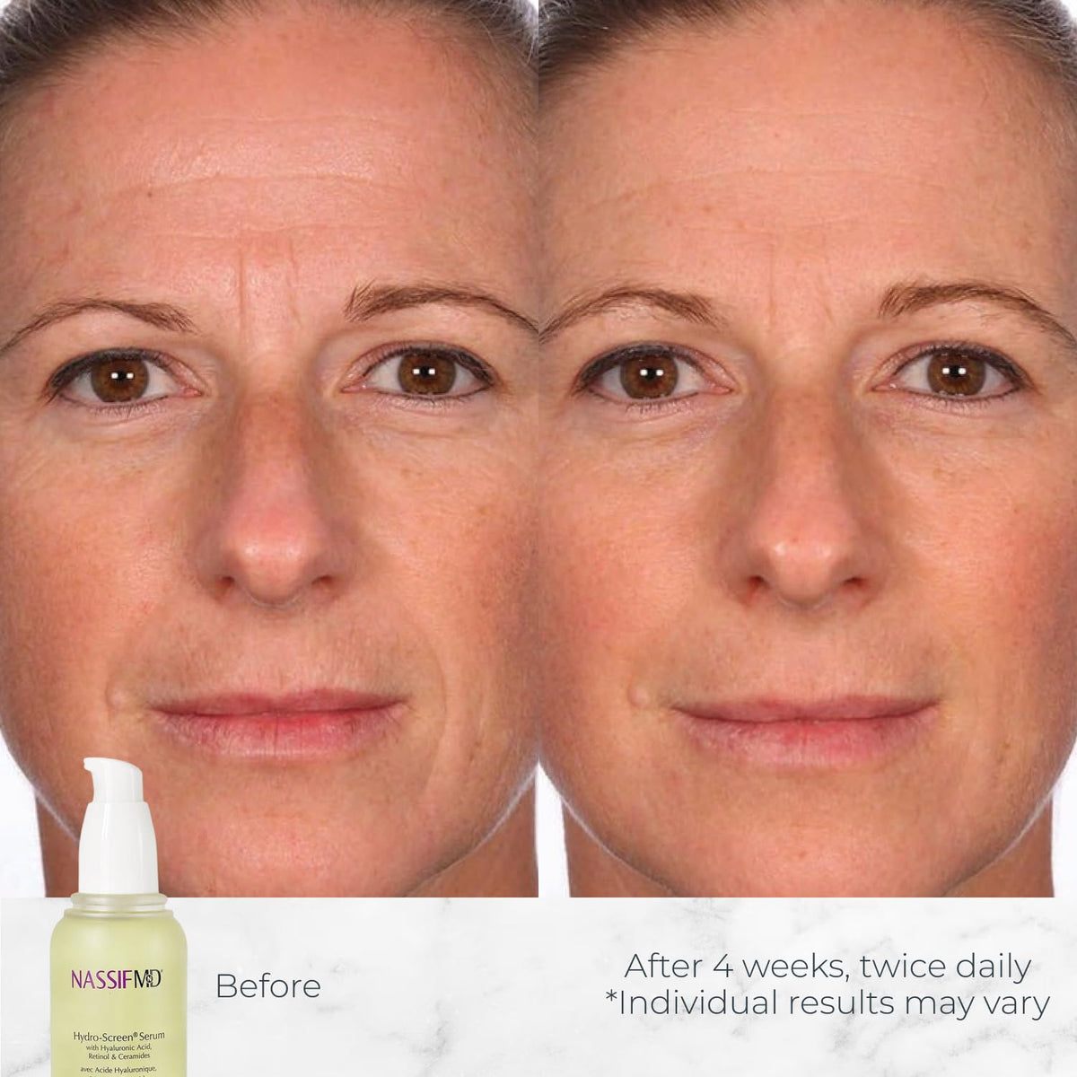 NassifMD serum texture close-up highlighting silky absorption benefit
