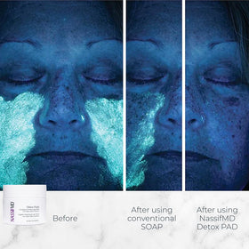 NassifMD close-up of a single pad texture for gentle exfoliation