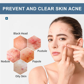 Natouch wipe in hand demonstrating portable use and quick on-the-go acne care