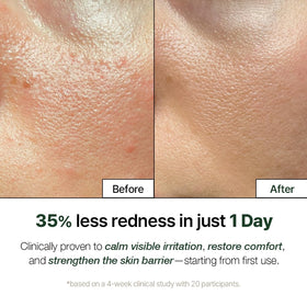 NATURAL DERMA PROJECT centella leaves and extract representing gentle soothing benefits