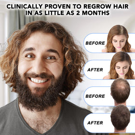 NATURE ZIRAN applying drops to scalp demonstrating targeted use