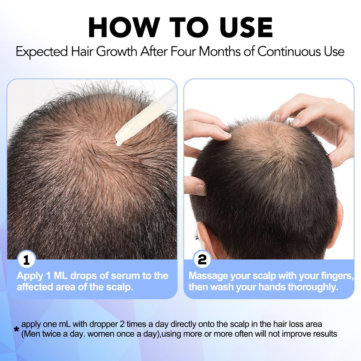 NATURE ZIRAN dropper applying to scalp demonstrating targeted use benefit