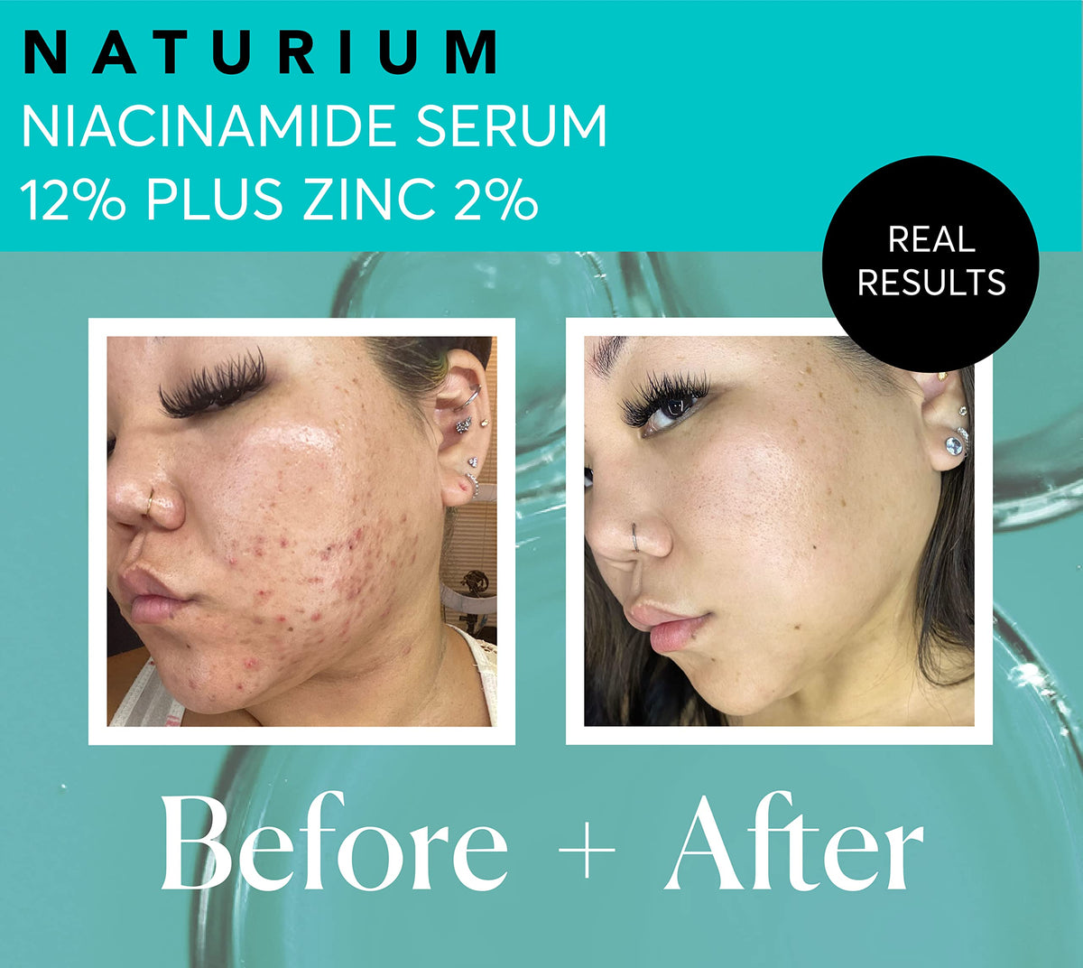Naturium label close-up highlighting niacinamide 12% and zinc 2% ingredient clarity