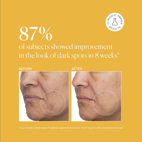 Naturium serum dispensed on hand to show consistency and easy spreadability