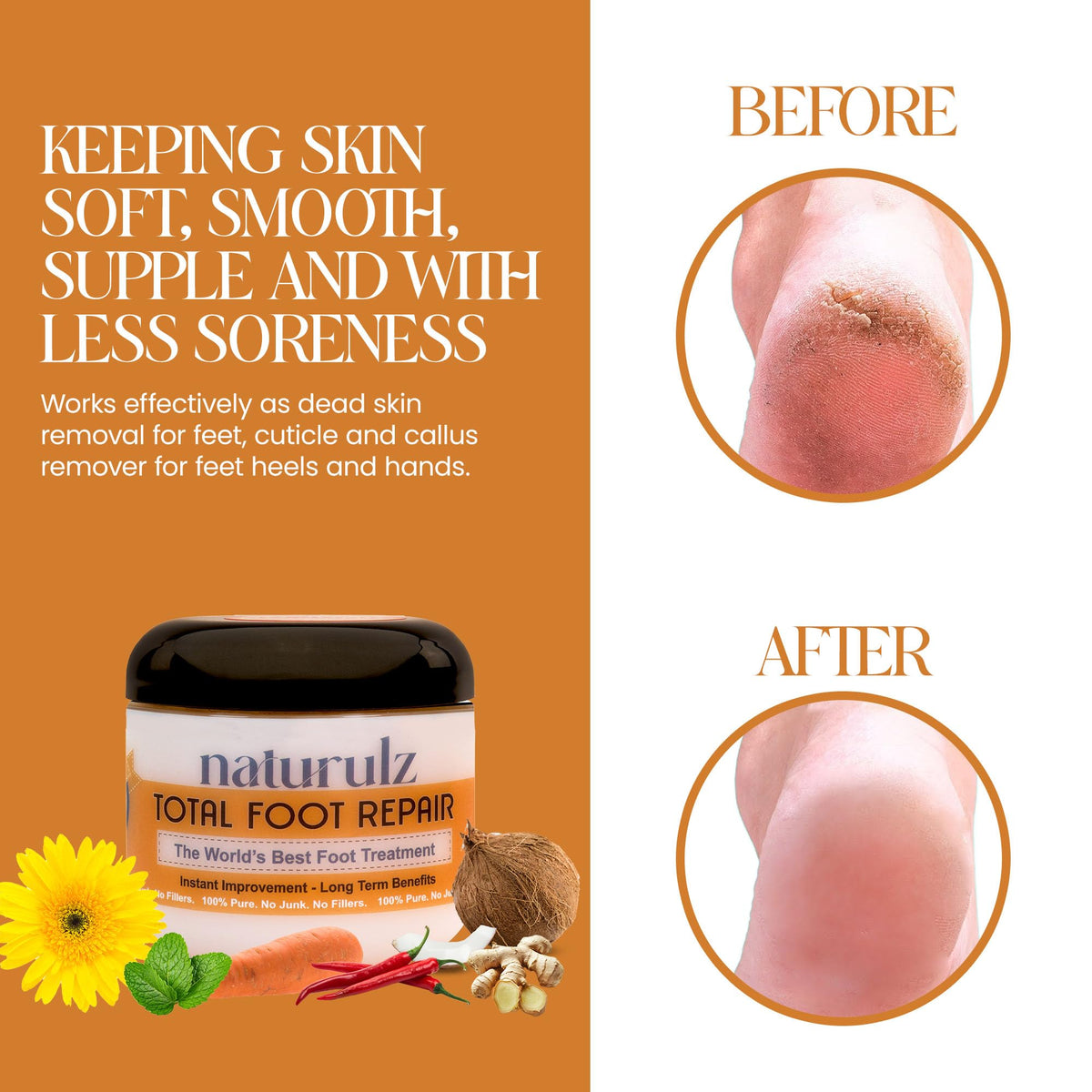 Naturulz being applied to a cracked heel demonstrating targeted relief