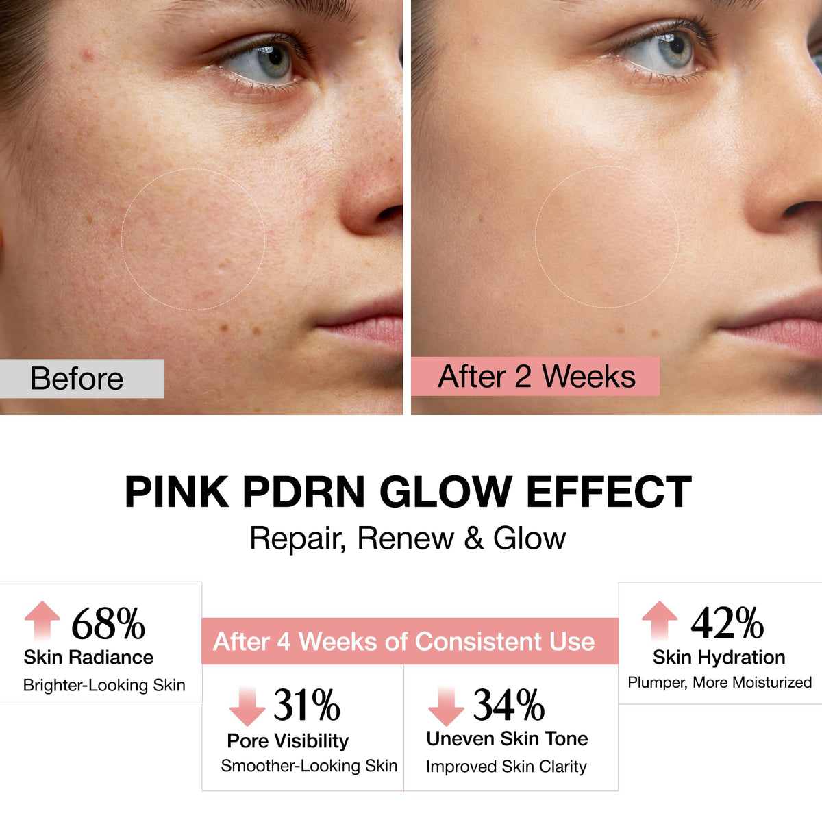 NAYROSA serum dropper dispensing pink serum, highlights precise application