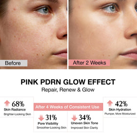 NAYROSA serum dropper dispensing pink serum, highlights precise application