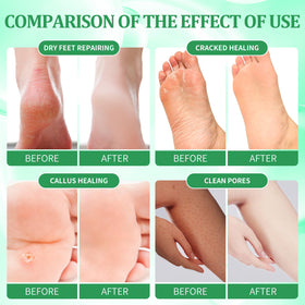nbc BeautiLab bubble salt dissolving in basin to soften and refresh feet